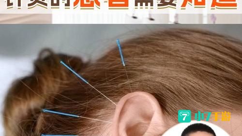 吴痛针灸什么梗
